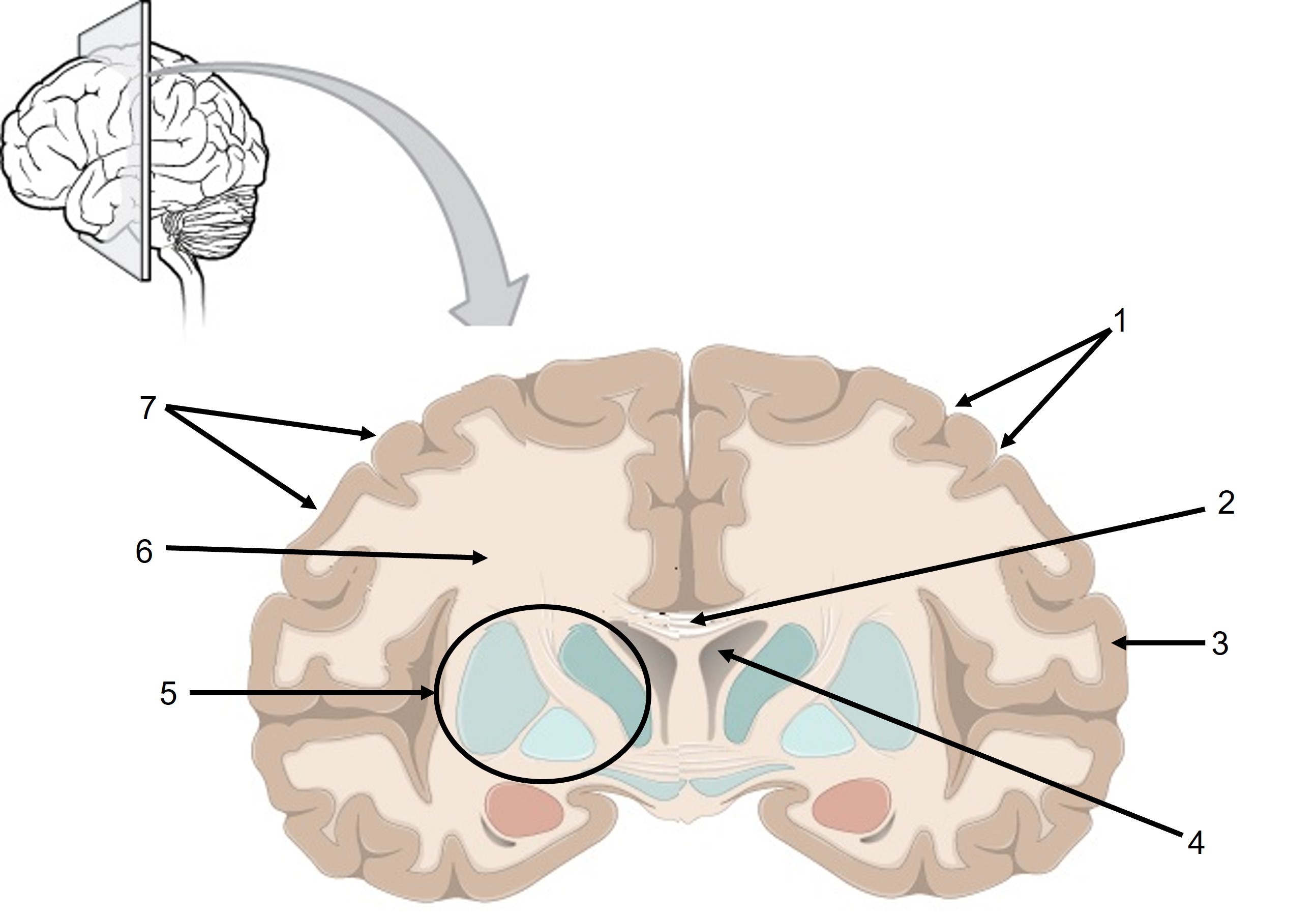 encephalon frontalsnit